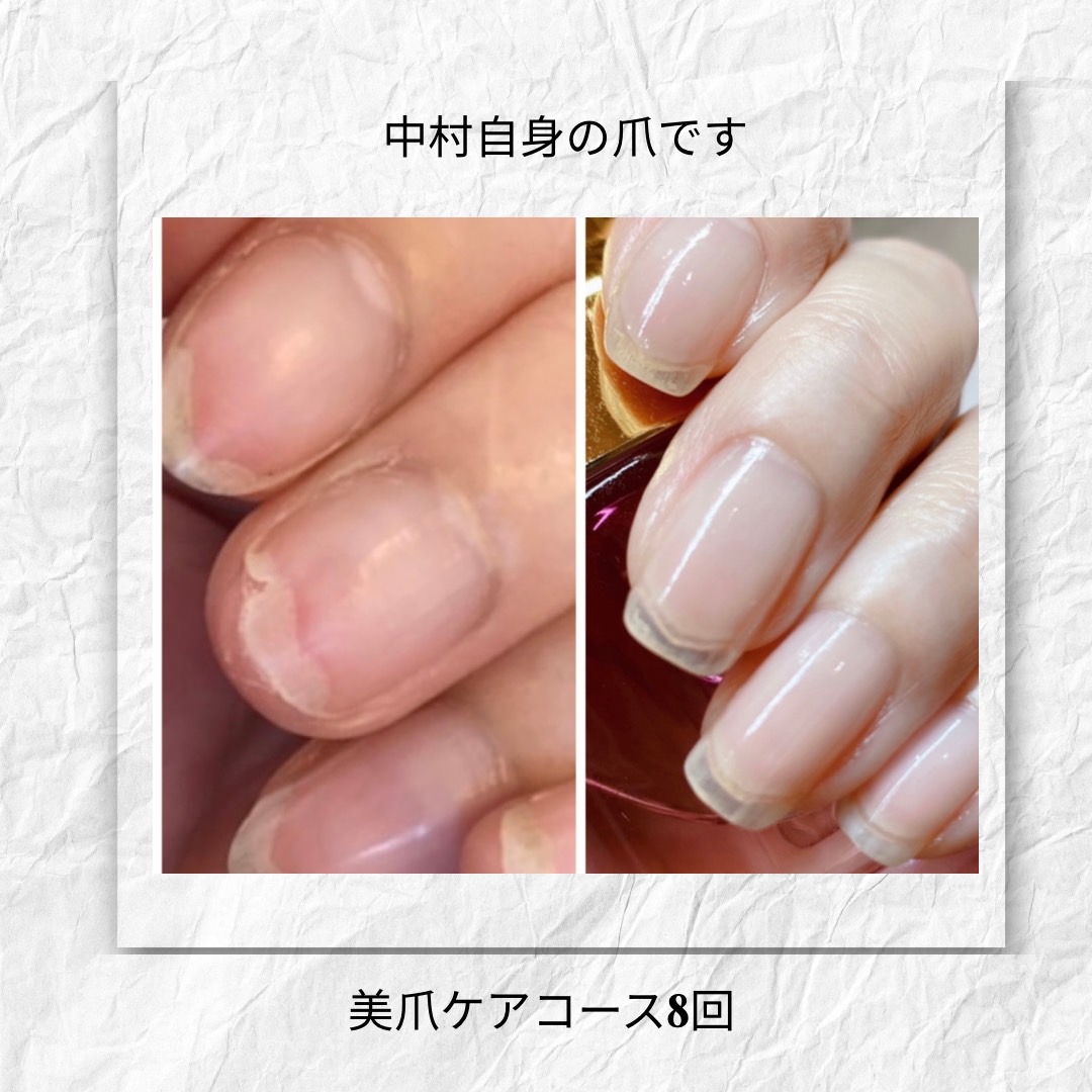voice3