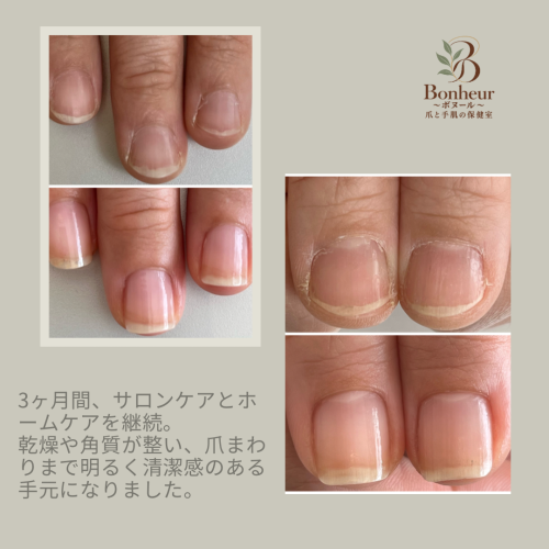 case_02