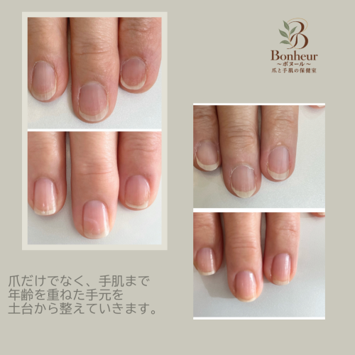case_03