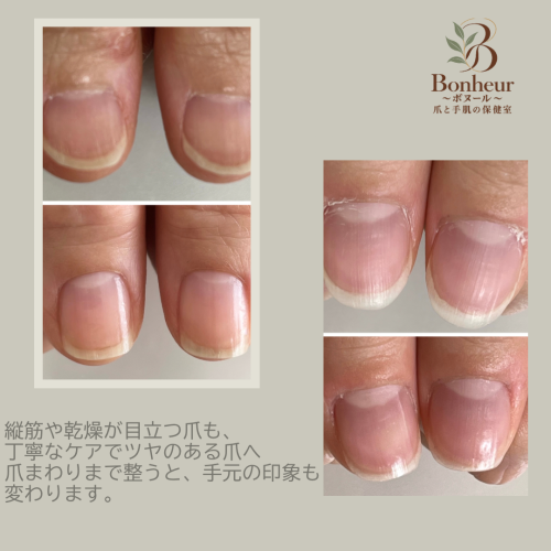 case_04