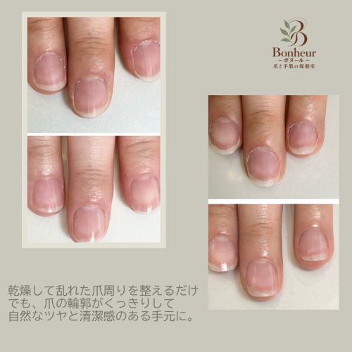 case_05
