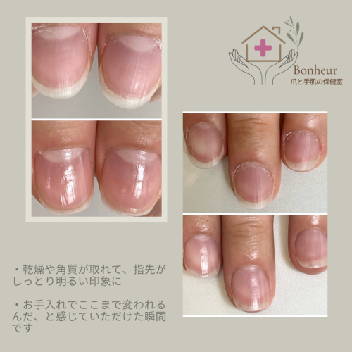 症例01
