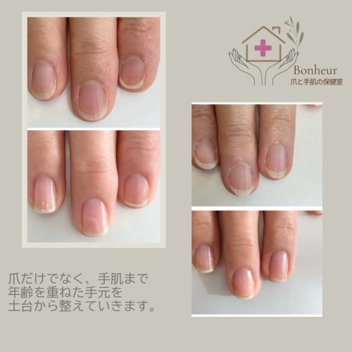 症例02