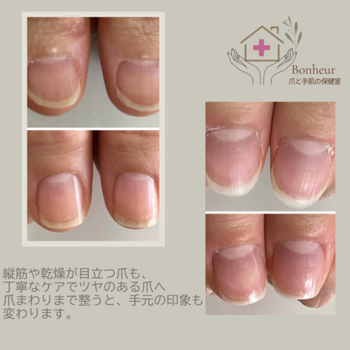 症例03