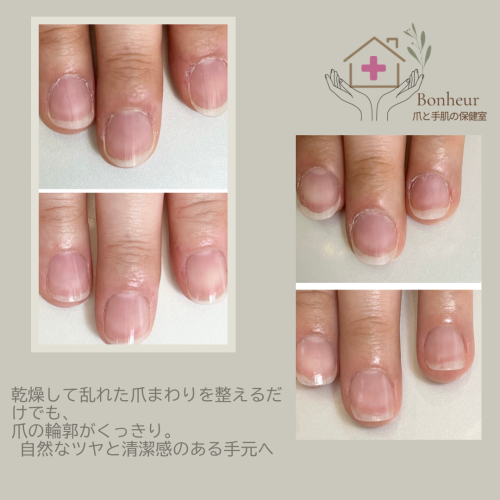 症例04